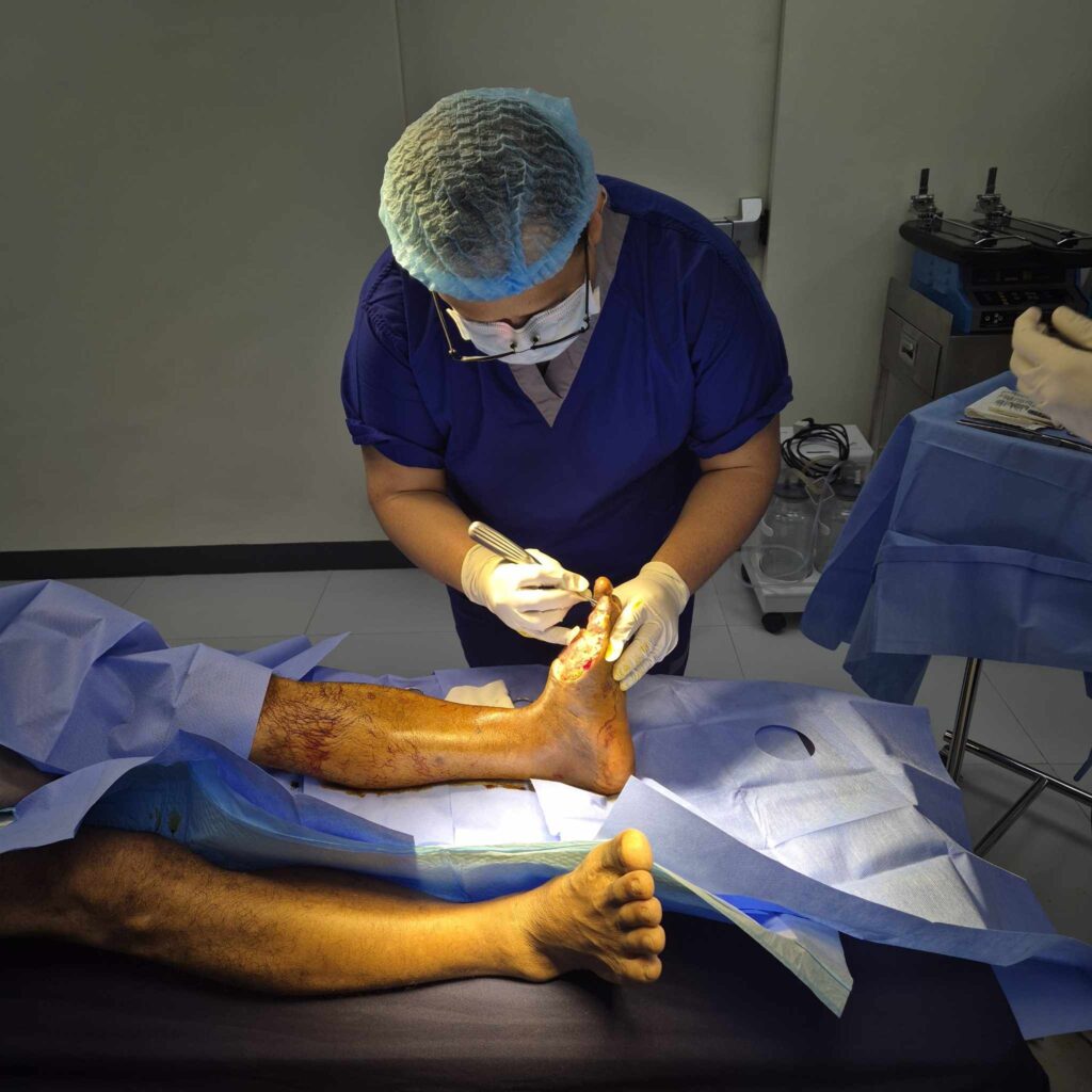 Debridement Services Quezon City Everything You Need to Know About Advanced Wound Treatment