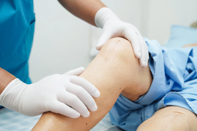 Your Guide to Affordable Knee Surgery and Long-Term Relief