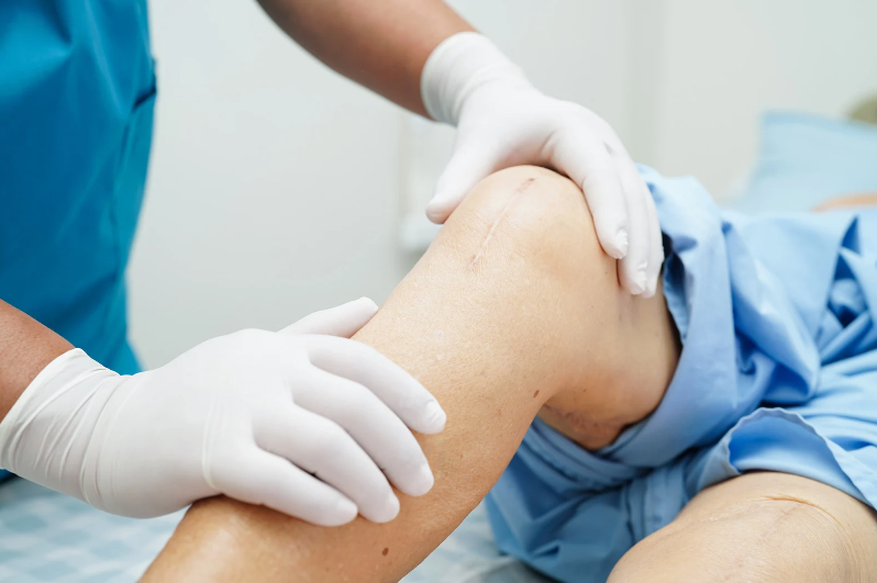 Your Guide to Affordable Knee Surgery and Long-Term Relief