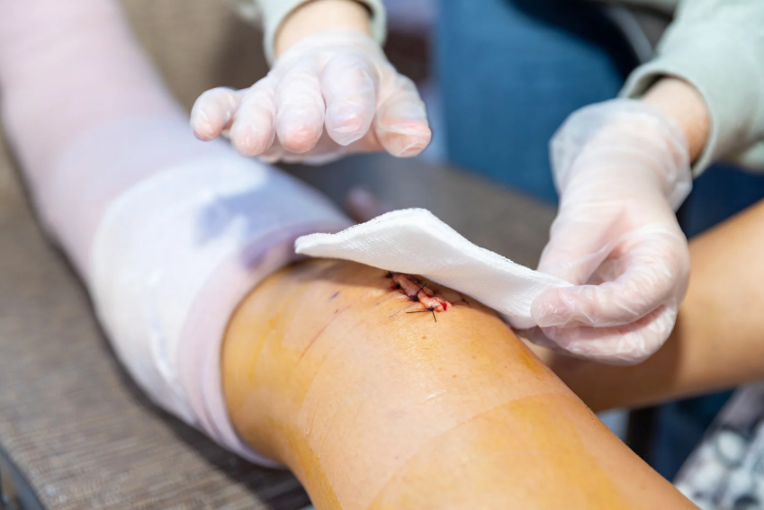 Specialized wound debridement services Philippines photo