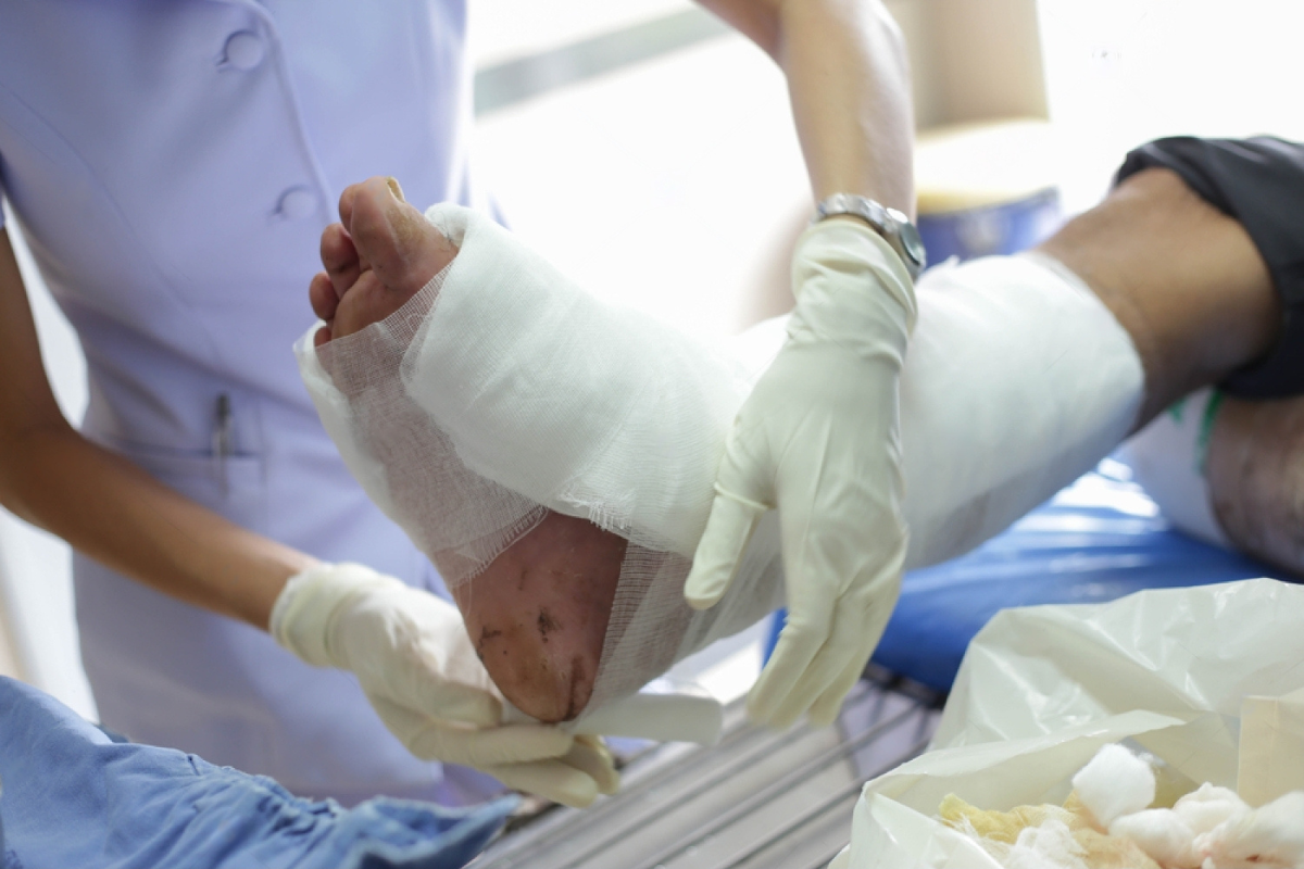 Orthopedic Treatment for Infected Wounds Effective Care Strategies for Faster Healing