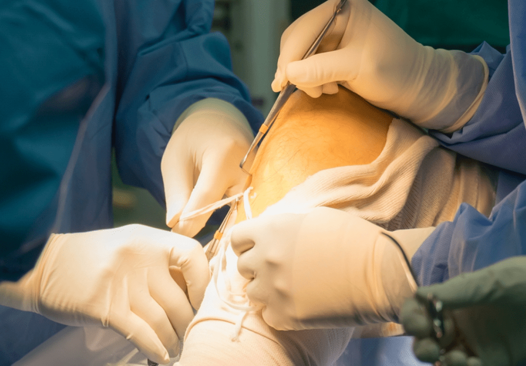 Finding the Right Arthroscopy Doctor A Complete Guide for Patients