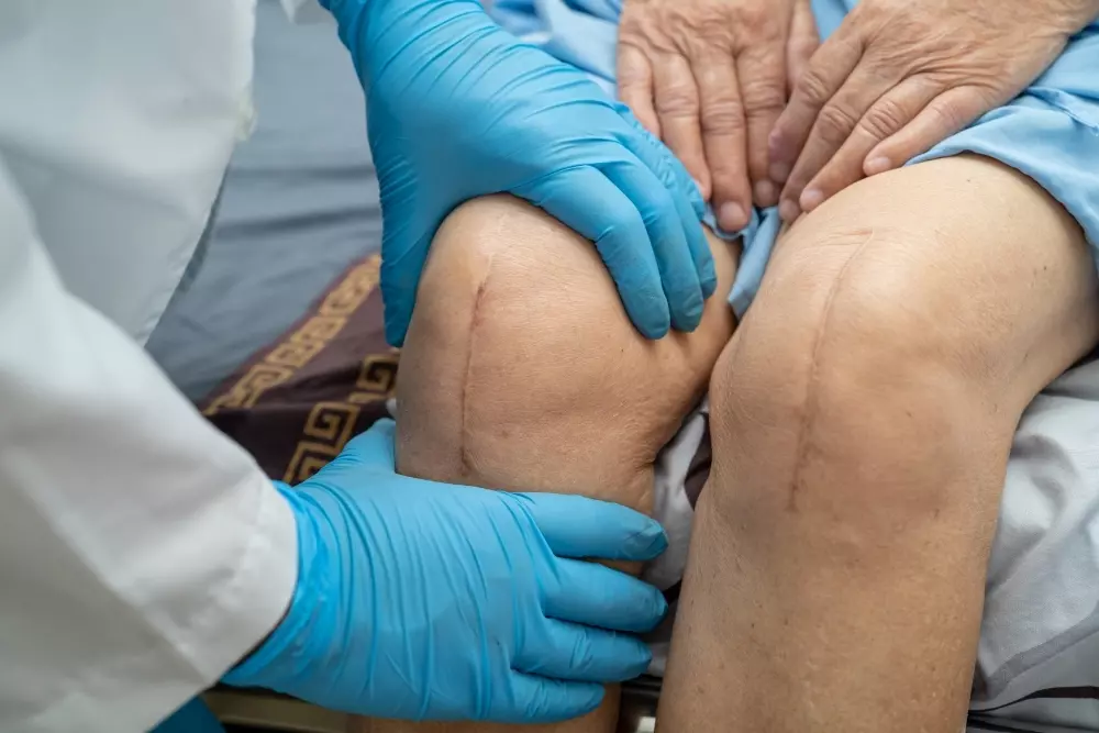 Understanding Total Knee Replacement What You Need to Know Before, During, and After Surgery